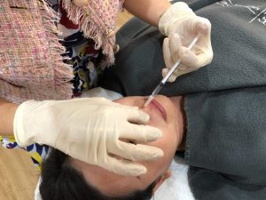 nose threadlift