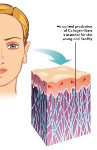 HIFU collagen